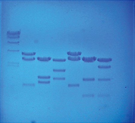 DNA fingerprints appear as dark blue lines in multiple columns on a light blue gel
