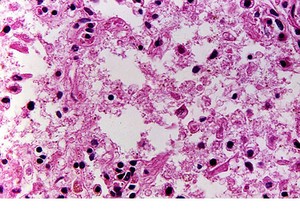 picture of lung tissue