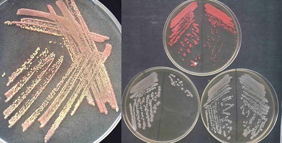 On the left, a close-up of a single agar plate streaked with bacteria. On the right, three agar plates, each with quadrant streaks of three different types of bacteria.