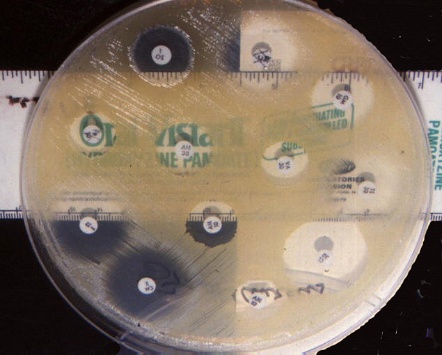 Bacteria grown in a petri dish avoid areas around paper disks spread throughout the dish
