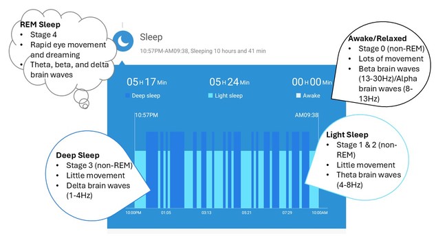 Image of sleep stages and associated brain waves.