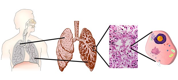 Picture of a respiratory system model made where a plastic bottle represents the ribcage, a straw is used as windpipe, and balloons represent the lungs.
