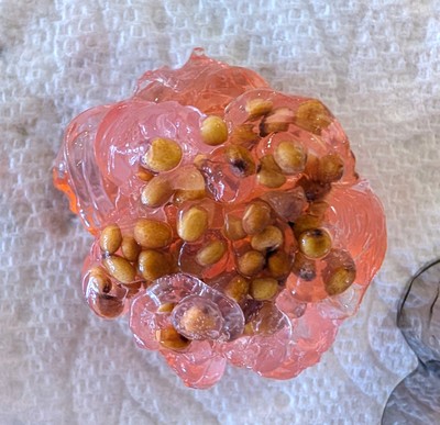 Picture of gel with seeds