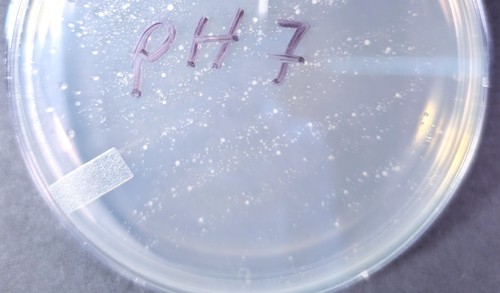 Agar plate with small microbe colonies
