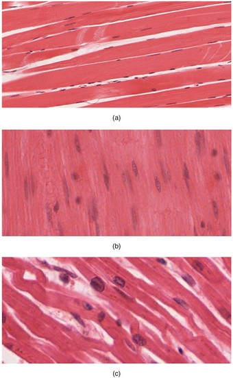 Picture of the three types of muscle tissue found in the human body: (a) skeletal muscle tissue, (b) smooth muscle tissue, and (c) cardiac muscle tissue.