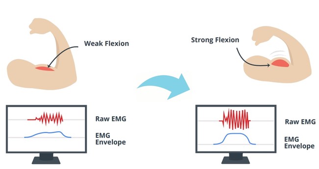 diagram showing EMG waveform with muscle contraction